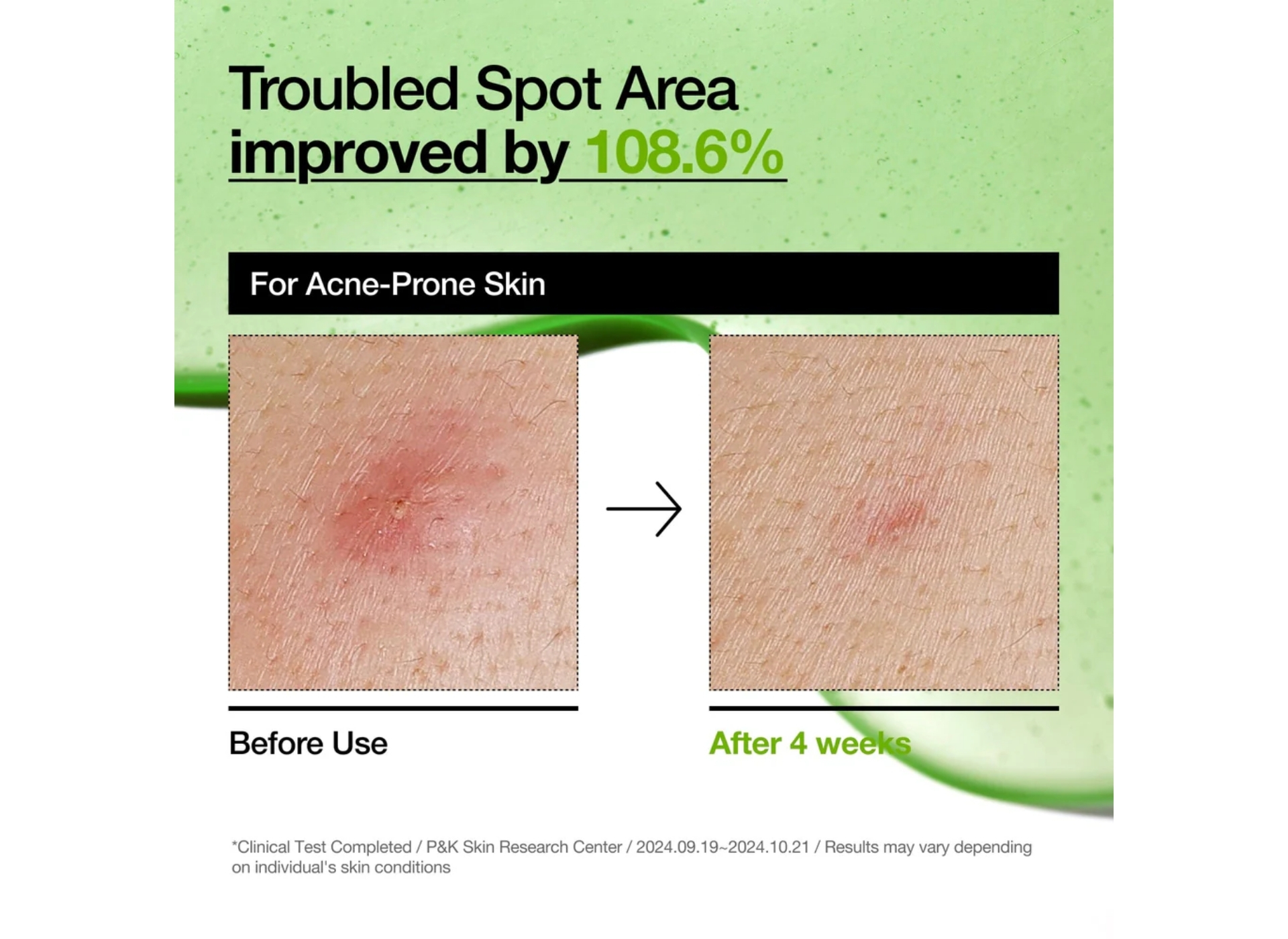 Azelaic Acid 10 Hyaluron Redness Soothing Serum - Image 6